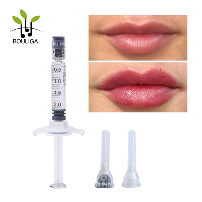 होंठ वृद्धि के लिए ओडीएम इंजेक्शन योग्य हाइलूरोनिक एसिड त्वचीय फिलर 2 मिलीलीटर